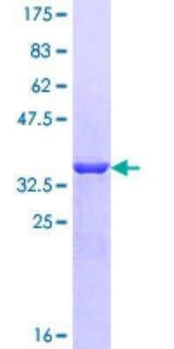 Novus Biologicals Recombinant Human ACYP2 GST (N-Term) Protein 25 &mu;g | Buy Online | Novus Biologicals&trade; | Fisher Scientific