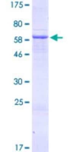 Novus Biologicals&trade;&nbsp;Recombinant Human ADAT3 GST (N-Term) Protein