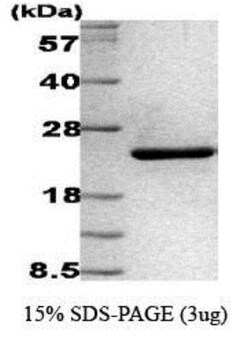 Novus Biologicals&trade;&nbsp;Recombinant Human AG-2/AGR2 His Protein