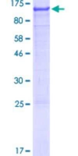 Novus Biologicals Recombinant Human AGAP2 GST (N-Term) Protein 10 &mu;g | Buy Online | Novus Biologicals&trade; | Fisher Scientific