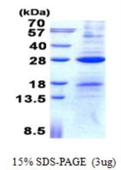 Novus Biologicals&trade;&nbsp;Recombinant Human AICDA His Protein
