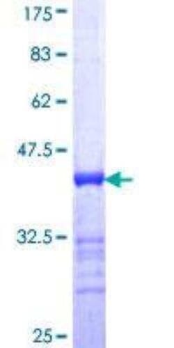 Novus Biologicals Recombinant Human AKAP4 GST (N-Term) Protein 25 &mu;g | Buy Online | Novus Biologicals&trade; | Fisher Scientific