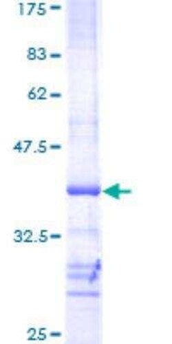 Novus Biologicals Recombinant Human AKT2 GST (N-Term) Protein 25 &mu;g | Buy Online | Novus Biologicals&trade; | Fisher Scientific