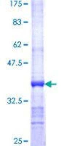 Novus Biologicals&trade;&nbsp;Recombinant Human ALAS2 GST (N-Term) Protein