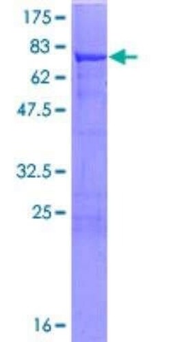 Novus Biologicals Recombinant Human ALDH7A1 GST (N-Term) Protein 10 &mu;g | Buy Online | Novus Biologicals&trade; | Fisher Scientific