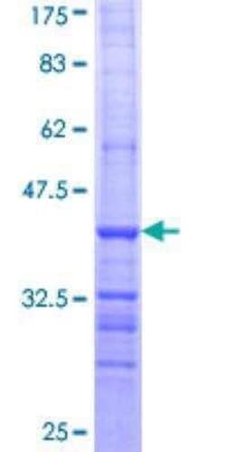Novus Biologicals Recombinant Human ALDH9A1 GST (N-Term) Protein 10 &mu;g | Buy Online | Novus Biologicals&trade; | Fisher Scientific