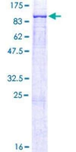 Novus Biologicals Recombinant Human ALOX12B GST (N-Term) Protein 10 &mu;g | Buy Online | Novus Biologicals&trade; | Fisher Scientific