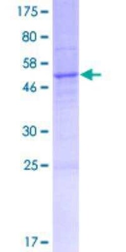 Novus Biologicals Recombinant Human ALOX12P2 GST (N-Term) Protein 25 &mu;g | Buy Online | Novus Biologicals&trade; | Fisher Scientific