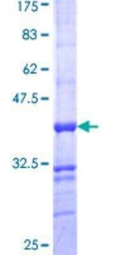 Novus Biologicals Recombinant Human ALPPL2 GST (N-Term) Protein 10 &mu;g | Buy Online | Novus Biologicals&trade; | Fisher Scientific