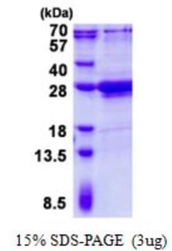 Novus Biologicals&trade;&nbsp;Recombinant Human AMELX His Protein