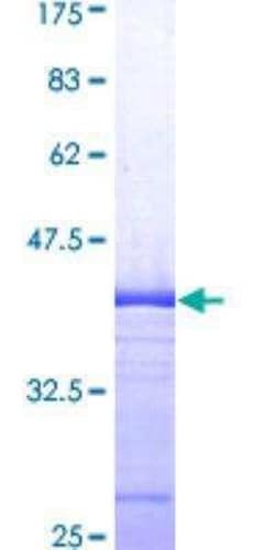 Novus Biologicals Recombinant Human AMFR/gp78 GST (N-Term) Protein 25 &mu;g | Buy Online | Novus Biologicals&trade; | Fisher Scientific