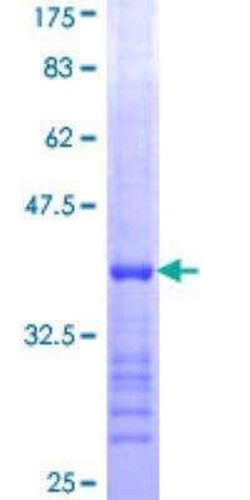 Novus Biologicals Recombinant Human AMPD3 GST (N-Term) Protein 10 &mu;g | Buy Online | Novus Biologicals&trade; | Fisher Scientific
