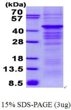 Novus Biologicals&trade;&nbsp;Recombinant Human AMPK beta 1 His Protein