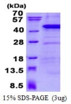 Novus Biologicals&trade;&nbsp;Recombinant Human ANKRD1 His Protein