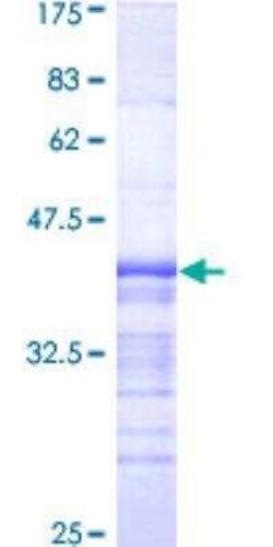 Novus Biologicals Recombinant Human APBB2 GST (N-Term) Protein 10 &mu;g | Buy Online | Novus Biologicals&trade; | Fisher Scientific
