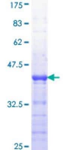 Novus Biologicals Recombinant Human APC GST (N-Term) Protein 25 &mu;g | Buy Online | Novus Biologicals&trade; | Fisher Scientific