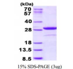 Novus Biologicals&trade;&nbsp;Recombinant Human ARC/NOL3 His Protein