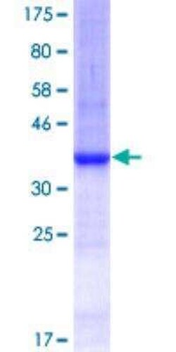 Novus Biologicals Recombinant Human ARHGAP1 GST (N-Term) Protein 25 &mu;g | Buy Online | Novus Biologicals&trade; | Fisher Scientific