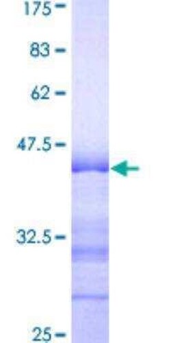 Novus Biologicals Recombinant Human ARHGAP4 GST (N-Term) Protein 25 &mu;g | Buy Online | Novus Biologicals&trade; | Fisher Scientific