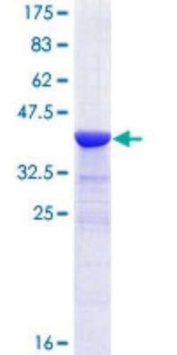 Novus Biologicals Recombinant Human ARHGAP6 GST (N-Term) Protein 25 &mu;g | Buy Online | Novus Biologicals&trade; | Fisher Scientific