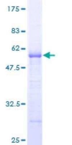 Novus Biologicals Recombinant Human ARHGDIG GST (N-Term) Protein 25 &mu;g | Buy Online | Novus Biologicals&trade; | Fisher Scientific