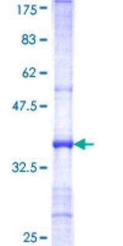 Novus Biologicals Recombinant Human ARSF GST (N-Term) Protein 10 &mu;g | Buy Online | Novus Biologicals&trade; | Fisher Scientific