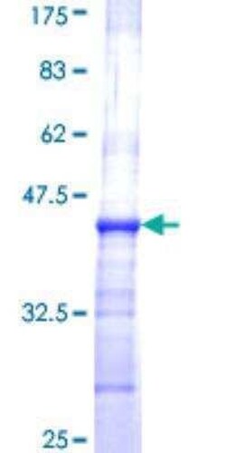 Novus Biologicals Recombinant Human ART3 GST (N-Term) Protein 10 &mu;g | Buy Online | Novus Biologicals&trade; | Fisher Scientific