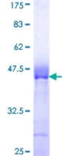 Novus Biologicals Recombinant Human ARVCF GST (N-Term) Protein 10 &mu;g | Buy Online | Novus Biologicals&trade; | Fisher Scientific