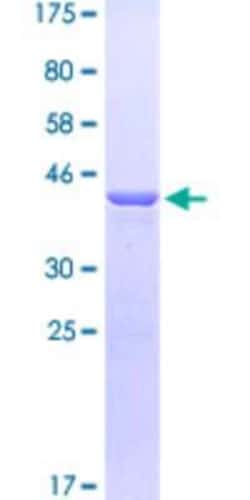 Novus Biologicals Recombinant Human ARX GST (N-Term) Protein 25 &mu;g | Buy Online | Novus Biologicals&trade; | Fisher Scientific