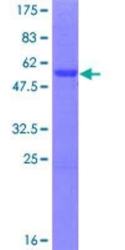 Novus Biologicals Recombinant Human ASCL2/Mash2 GST (N-Term) Protein 2 &mu;g | Buy Online | Novus Biologicals&trade; | Fisher Scientific