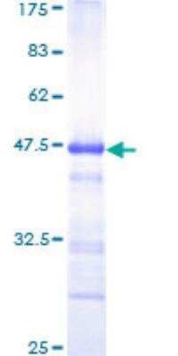 Novus Biologicals Recombinant Human ATBF1/ZFHX3 GST (N-Term) Protein 25 &mu;g | Buy Online | Novus Biologicals&trade; | Fisher Scientific