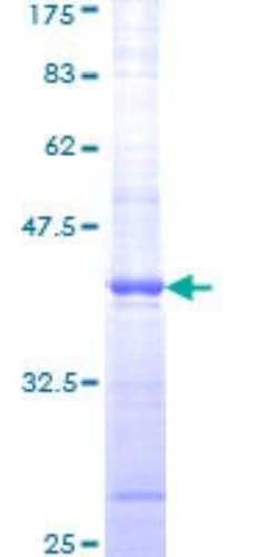 Novus Biologicals Recombinant Human ATM GST (N-Term) Protein 10 &mu;g | Buy Online | Novus Biologicals&trade; | Fisher Scientific