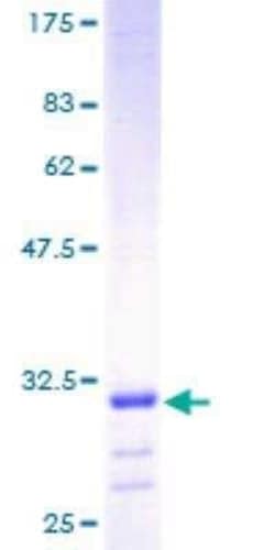 Novus Biologicals Recombinant Human ATP5E GST (N-Term) Protein 25 &mu;g | Buy Online | Novus Biologicals&trade; | Fisher Scientific