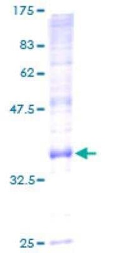 Novus Biologicals Recombinant Human ATP5G2 GST (N-Term) Protein 25 &mu;g | Buy Online | Novus Biologicals&trade; | Fisher Scientific