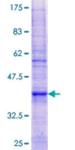 Novus Biologicals Recombinant Human ATP5G3 GST (N-Term) Protein 10 &mu;g | Buy Online | Novus Biologicals&trade; | Fisher Scientific