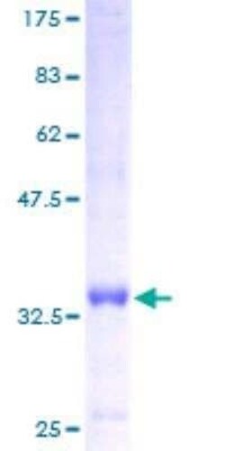 Novus Biologicals Recombinant Human ATP5I GST (N-Term) Protein 25 &mu;g | Buy Online | Novus Biologicals&trade; | Fisher Scientific