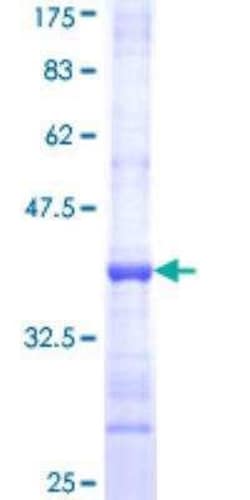 Novus Biologicals Recombinant Human ATP5J GST (N-Term) Protein 10 &mu;g | Buy Online | Novus Biologicals&trade; | Fisher Scientific
