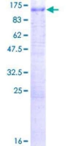 Novus Biologicals Recombinant Human ATP6V0A1 GST (N-Term) Protein 2 &mu;g | Buy Online | Novus Biologicals&trade; | Fisher Scientific