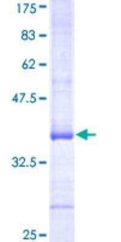 Novus Biologicals Recombinant Human ATP6V0A1 GST (N-Term) Protein 25 &mu;g | Buy Online | Novus Biologicals&trade; | Fisher Scientific