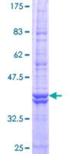Novus Biologicals Recombinant Human ATP6V0C GST (N-Term) Protein 10 &mu;g | Buy Online | Novus Biologicals&trade; | Fisher Scientific