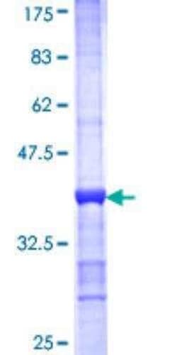 Novus Biologicals Recombinant Human ATP6V1A GST (N-Term) Protein 10 &mu;g | Buy Online | Novus Biologicals&trade; | Fisher Scientific
