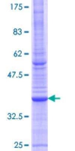 Novus Biologicals Recombinant Human ATP6V1B1 GST (N-Term) Protein 25 &mu;g | Buy Online | Novus Biologicals&trade; | Fisher Scientific