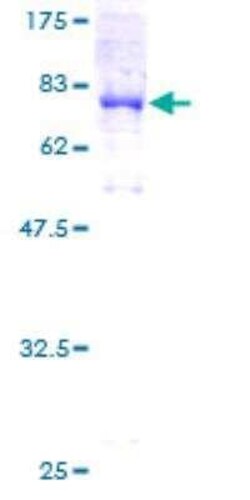Novus Biologicals Recombinant Human ATP6V1B2 GST (N-Term) Protein 10 &mu;g | Buy Online | Novus Biologicals&trade; | Fisher Scientific