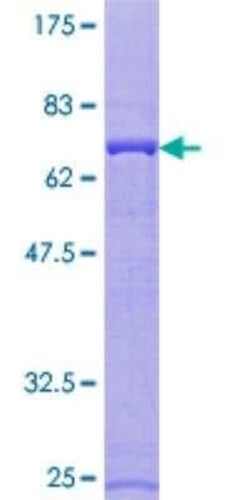Novus Biologicals Recombinant Human ATP6V1C1 GST (N-Term) Protein 10 &mu;g | Buy Online | Novus Biologicals&trade; | Fisher Scientific