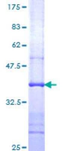 Novus Biologicals Recombinant Human ATP6V1C1 GST (N-Term) Protein 10 &mu;g | Buy Online | Novus Biologicals&trade; | Fisher Scientific