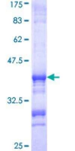 Novus Biologicals Recombinant Human ATP6V1E1 GST (N-Term) Protein 25 &mu;g | Buy Online | Novus Biologicals&trade; | Fisher Scientific