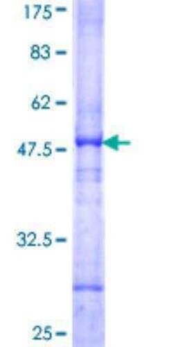 Novus Biologicals Recombinant Human Aconitase 2 GST (N-Term) Protein 10 &mu;g | Buy Online | Novus Biologicals&trade; | Fisher Scientific