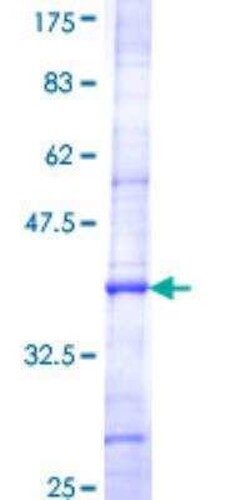 Novus Biologicals Recombinant Human Acyloxyacyl Hydrolase GST (N-Term) Protein 10 &mu;g | Buy Online | Novus Biologicals&trade; | Fisher Scientific