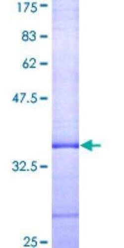 Novus Biologicals Recombinant Human Adenosine A3 R GST (N-Term) Protein 10 &mu;g | Buy Online | Novus Biologicals&trade; | Fisher Scientific
