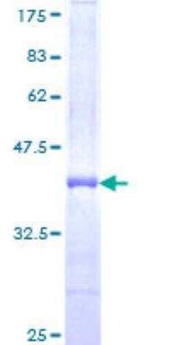 Novus Biologicals Recombinant Human Adenylate Cyclase 2 GST (N-Term) Protein